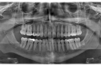 Xray Xray